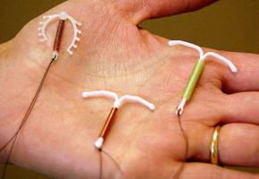 Que penser du stérilet?