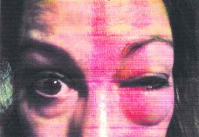 Valérie a fait attester ses blessures auprès de Genève-Médecin.