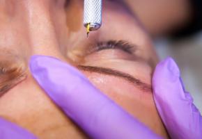 Des pigments sont implantés dans le derme. GETTY IMAGES/STOCKPHOTOGRAPHERS 