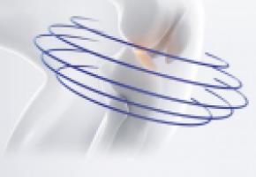 Si elle peut toucher n’importe quelle articulation, l’arthrose sévit le plus souvent dans les genoux DR  