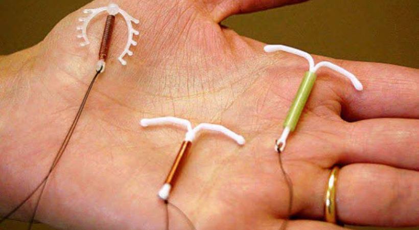 Que penser du stérilet?