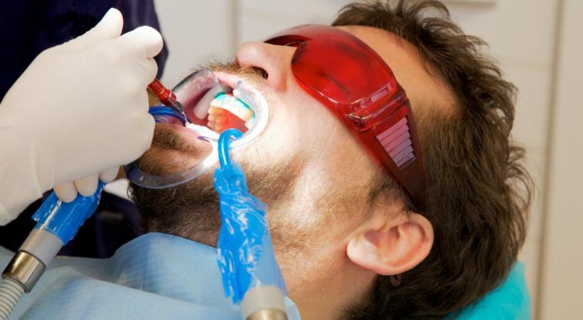 L’utilisation de produits chimiques pour blanchir les dents est très encadrée par la loi. 123RF/FABIANAPONZI